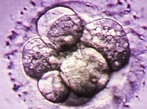 沧州南皮县做试管婴儿的医院有哪些？沧州南皮县做试管婴儿的医院有哪些呢